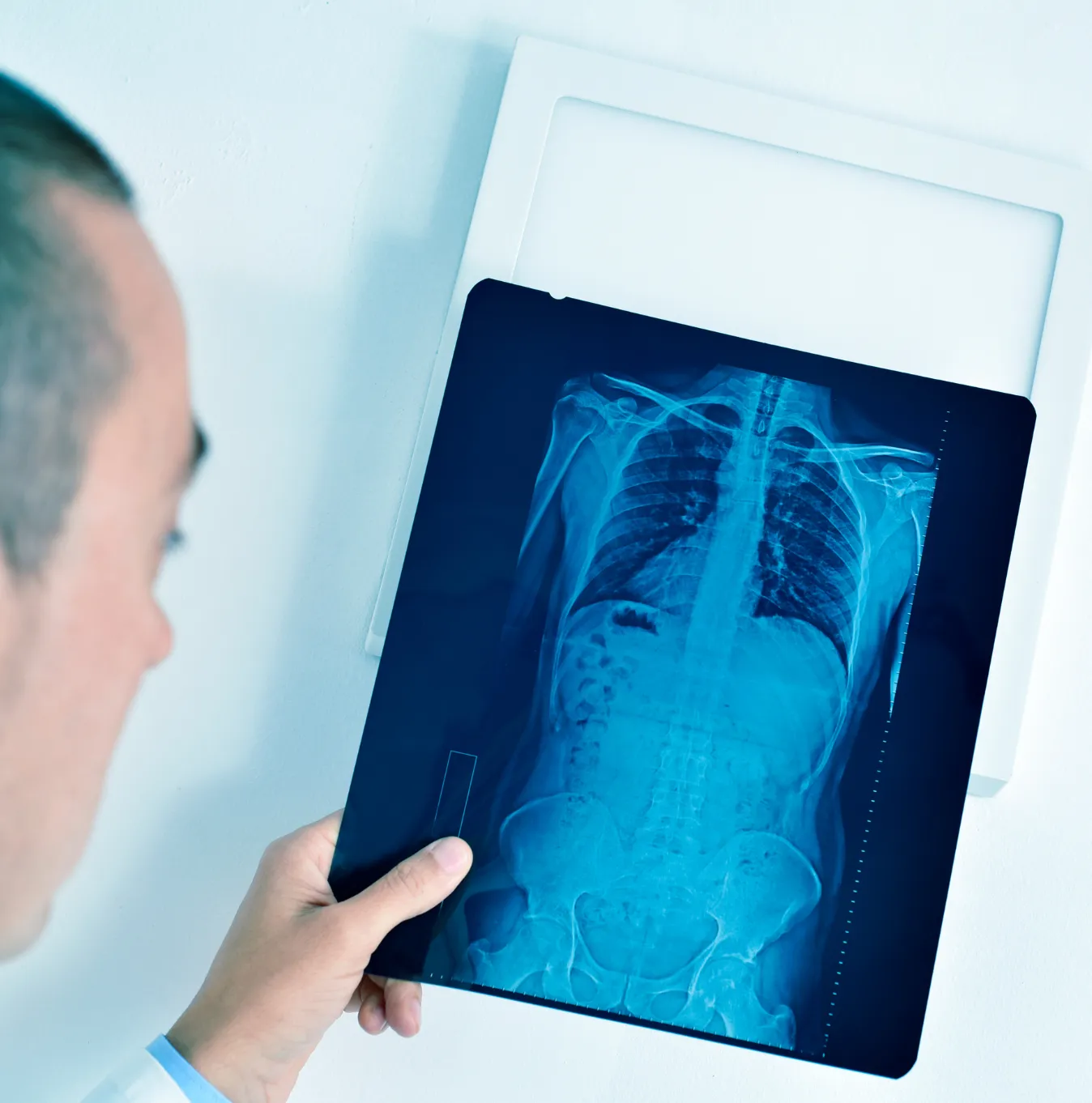 Thoracic Billing Services